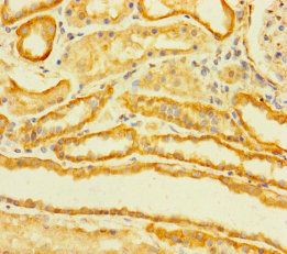 TMEM120B Antibody