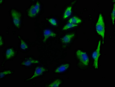 TMEM131L Antibody