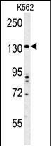 TMEM132D antibody