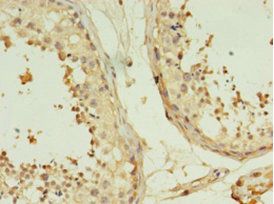 TMEM141 antibody