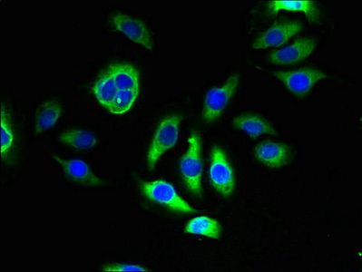 TMEM143 antibody