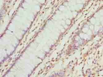 TMEM143 Antibody