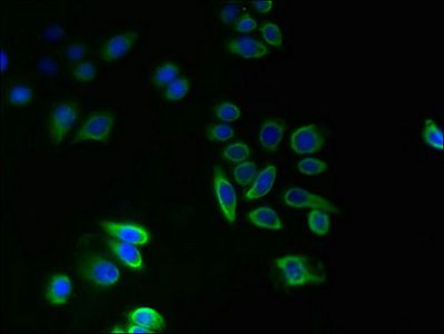 TMEM14A Antibody