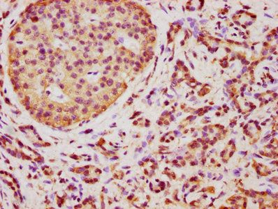 TMEM14A Antibody