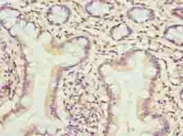TMEM154 antibody
