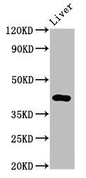 TMEM161A antibody