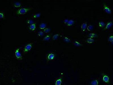 TMEM165 antibody