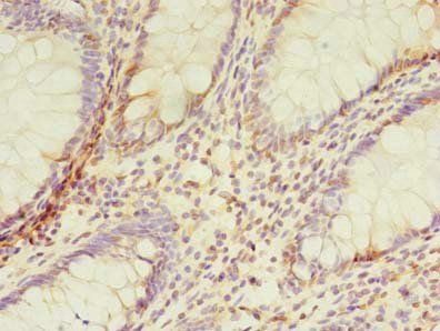 TMEM165 Antibody