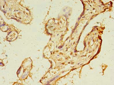 TMEM165 Antibody