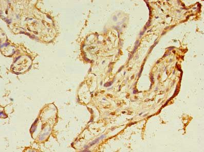 TMEM165 antibody