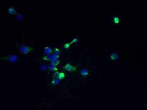 TMEM174 antibody