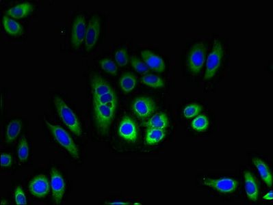 TMEM184C Antibody