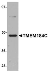 TMEM184C Antibody