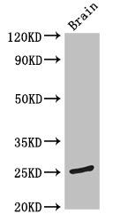 TMEM186 Antibody