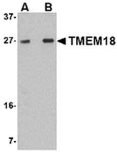 TMEM18 Antibody