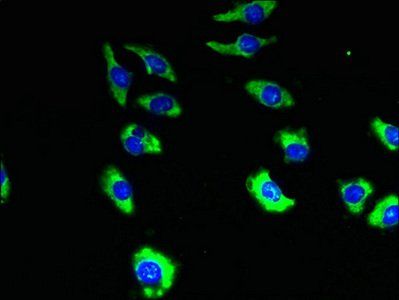 TMEM19 antibody