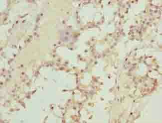 TMEM19 Antibody
