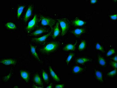 TMEM192 Antibody