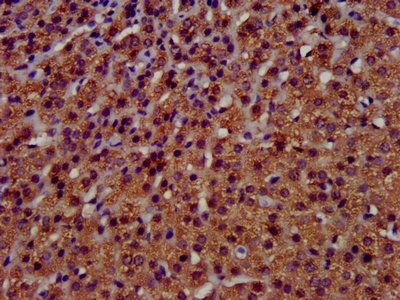 TMEM192 Antibody