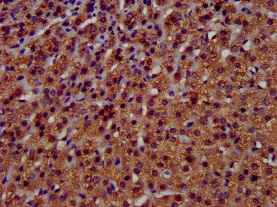 TMEM192 antibody