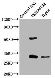TMEM192 Antibody