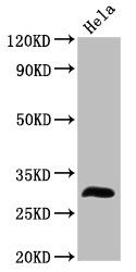 TMEM192 antibody