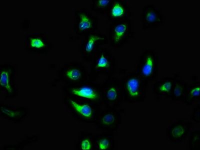 TMEM2 Antibody