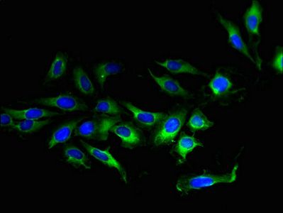 TMEM207 Antibody