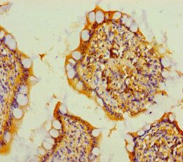 TMEM207 Antibody