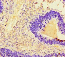 TMEM207 Antibody