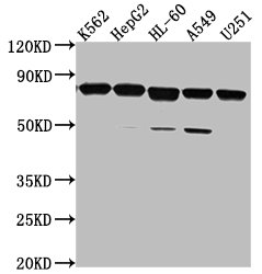 TMEM214 Antibody
