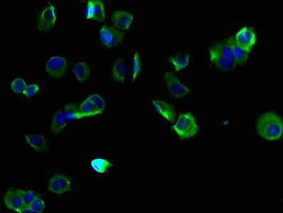 TMEM255B Antibody