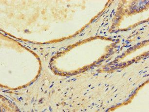TMEM255B Antibody