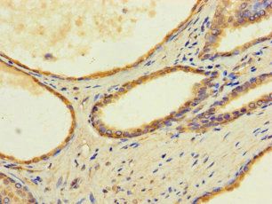 TMEM255B antibody