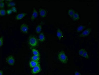 TMEM38B antibody