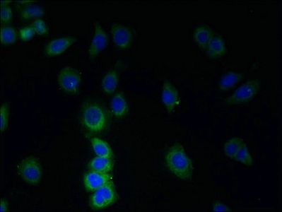 TMEM38B Antibody