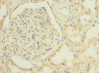TMEM38B Antibody