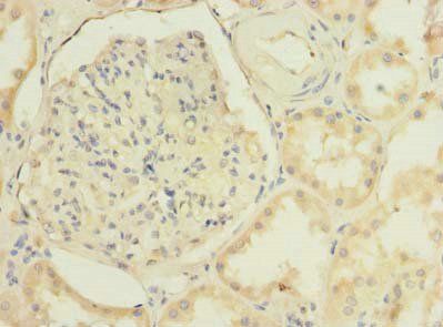 TMEM38B antibody