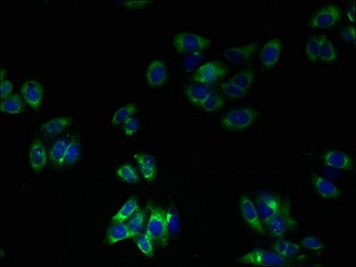 TMEM41A Antibody