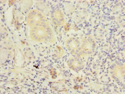 TMEM41A Antibody