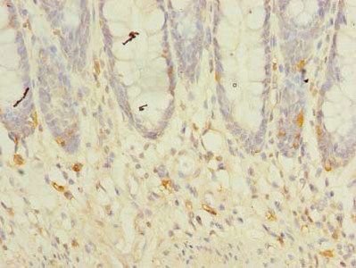 TMEM41A Antibody