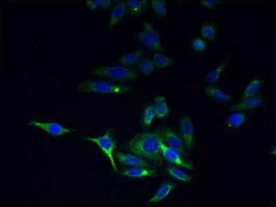 TMEM44 antibody