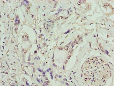 TMEM53 Antibody
