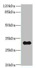 TMEM53 Antibody