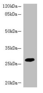 PIP4P2 Antibody