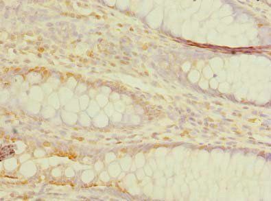 TMEM59L Antibody