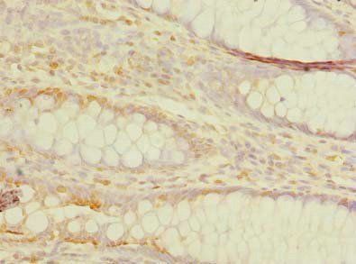 TMEM59L antibody