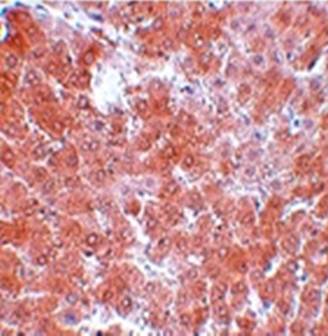 TMEM70 Rabbit Polyclonal Antibody