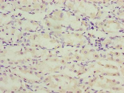 TMEM71 Antibody