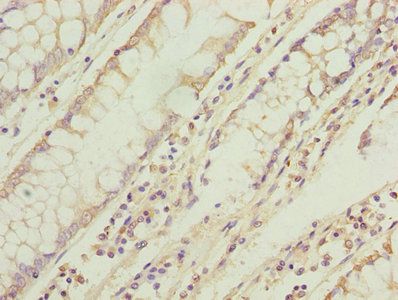 TMEM71 Antibody